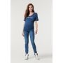 Supermom Skinny jeans Skinny Blue - Acid Blue